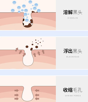 去黑頭磨皮鼻貼